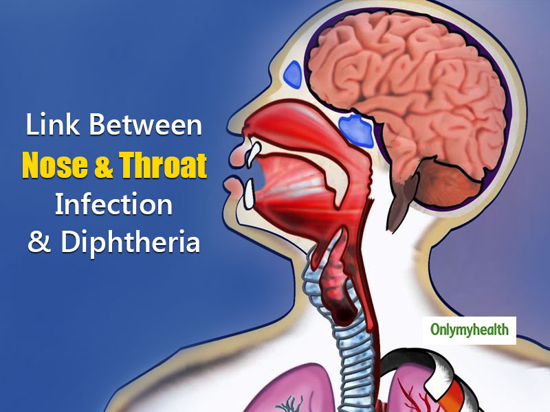 Nose And Throat Diseases Can Be A Reason Of Diphtheria, Claim Experts
